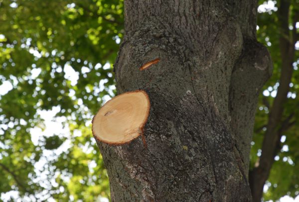 Cost of Limb Cutting in Hampstead